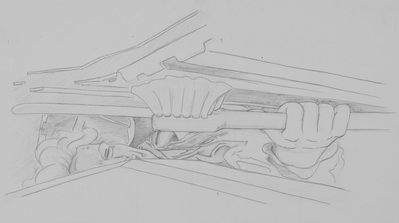 Sketch For 'Under a Hummer'